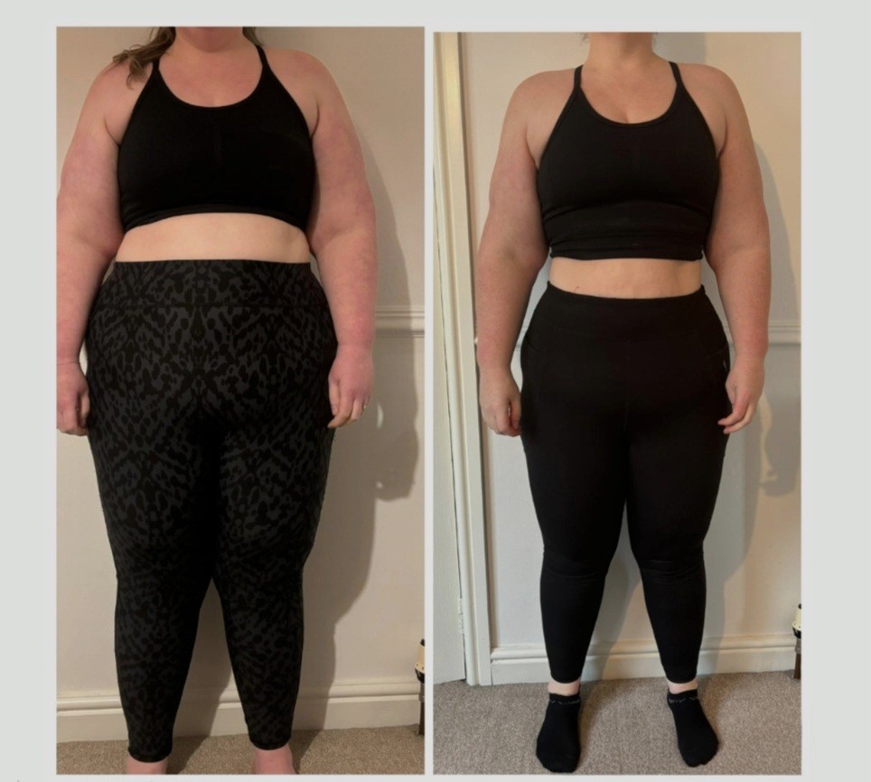 Emma before and after transformation photo