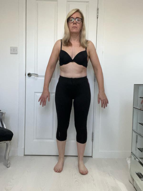 Susan after Project Strong