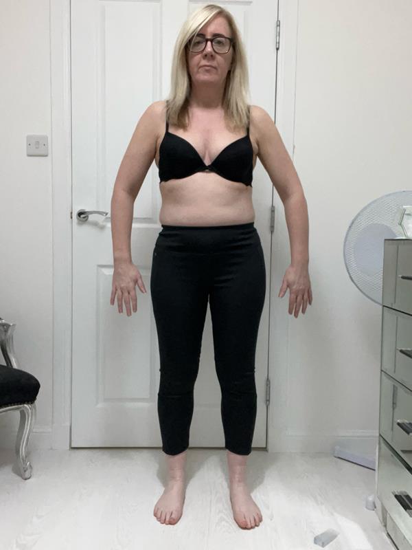 Susan before Project Strong